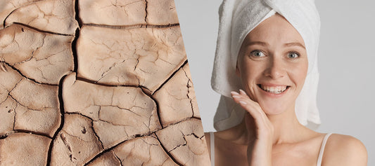 Perché hai la pelle secca? Cause e rimedi naturali